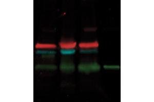 Simultaneous detection of three proteins on a single blot using -labeled secondary antibody conjugates. (DyLight™ Multiplex 549/800 Duo Western Blot Kit)