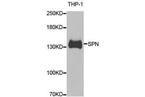Western blot analysis of extracts of THP-1 cells, using SPN antibody. (CD43 抗体  (AA 276-400))