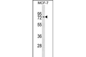 GNL1 Antibody (Center) (ABIN1538160 and ABIN2849092) western blot analysis in MCF-7 cell line lysates (35 μg/lane). (GNL1 抗体  (AA 240-266))