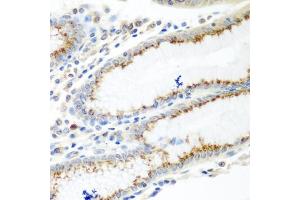 Immunohistochemistry of paraffin-embedded human stomach using UBI antibody (ABIN6134946, ABIN6149845, ABIN6149848 and ABIN6223555) at dilution of 1:100 (40x lens). (UBIAD1 抗体  (AA 1-100))