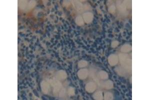 Used in DAB staining on fromalin fixed paraffin- embedded rectum tissue (PA2G4 抗体  (AA 2-394))
