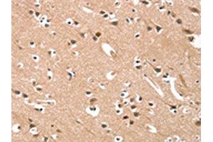 The image on the left is immunohistochemistry of paraffin-embedded Human brain tissue using ABIN7190421(CYP46A1 Antibody) at dilution 1/15, on the right is treated with synthetic peptide. (CYP46A1 抗体)