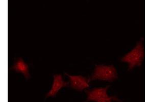 ABIN6267243 staining HuvEc by IF/ICC. (Nibrin 抗体  (pSer343))