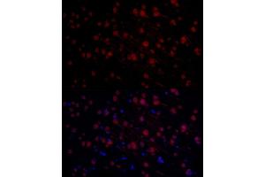 Immunofluorescence (IF) image for anti-N-Myc Proto-Oncogene Protein (MYCN) (AA 168-267) antibody (ABIN1680957)