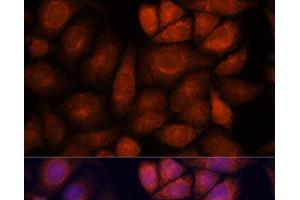 Immunofluorescence analysis of HeLa cells using KIF13A Polyclonal Antibody at dilution of 1:100. (KIF13A 抗体)
