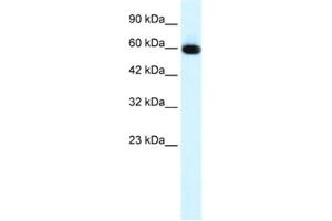 Western Blotting (WB) image for anti-GLIS Family Zinc Finger 2 (GLIS2) antibody (ABIN2460154) (GLIS2 抗体)