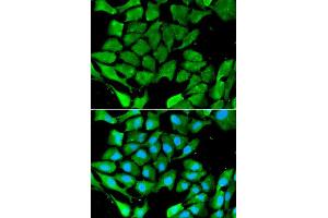 Immunofluorescence analysis of A549 cell using PPARG antibody. (PPARG 抗体  (AA 50-150))