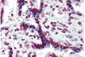 Human Placenta: Formalin-Fixed, Paraffin-Embedded (FFPE) (Aryl Hydrocarbon Receptor 抗体  (AA 279-376))