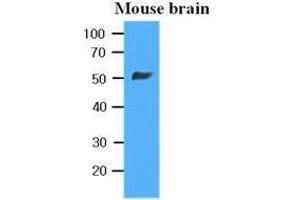 The extracts of Mouse brain (35 ug) were resolved by SDS-PAGE, transferred to PVDF membrane and probed with anti-human beta-Tubulin (1:10000). (TUBB 抗体  (AA 1-445))