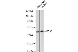 Western blot analysis of extracts of various cell lines, using DDB2 antibody (ABIN3022631, ABIN3022632, ABIN3022633 and ABIN6218976) at 1:500 dilution. (DDB2 抗体  (AA 1-315))