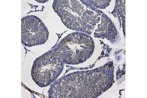 Immunohistochemistry (IHC) image for anti-Glutathione S-Transferase mu 3 (Brain) (GSTM3) antibody (ABIN5708464)
