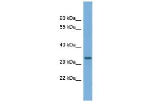 Host:  Rabbit  Target Name:  T Sample Type:  OVCAR-3 Whole Cell lysates  Antibody Dilution:  1. (TAM41 抗体  (C-Term))