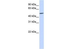 Image no. 1 for anti-Homeobox even-skipped homolog protein 2 (EVX2) (C-Term) antibody (ABIN6740651) (EVX2 抗体  (C-Term))