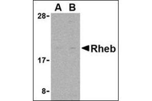 Western blot analysis of Rheb in rat heart cell lysate with this product at (A) 2 and (B) 4 μg/ml. (RHEB 抗体  (N-Term))