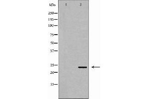 Western blot analysis of HepG2 cell lysate, using ORM1 Antibody. (ORM1 抗体  (Internal Region))