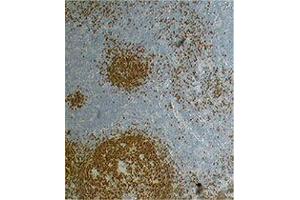 Immunohistochemistry (IHC) image for anti-Paired Box 5 (PAX5) antibody (ABIN2667347) (PAX5 抗体)