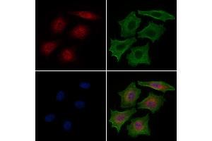 ABIN6263167 and ABIN6276541 staining HepG2 cells by IF/ICC.