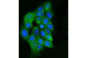 anti-Integrin-Linked Kinase (ILK) (AA 1-452) antibody