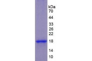 SDS-PAGE analysis of Human Keratin 1 Protein. (Cytokeratin 1 蛋白)