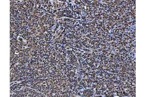 IHC analysis of TIP49A/RUVBL1 using anti-TIP49A/RUVBL1 antibody (ABIN7599928). (RUVBL1 抗体  (AA 13-23))
