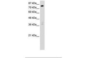 Image no. 1 for anti-TSC22 Domain Family, Member 2 (TSC22D2) (C-Term) antibody (ABIN6736248) (TSC22D2 抗体  (C-Term))