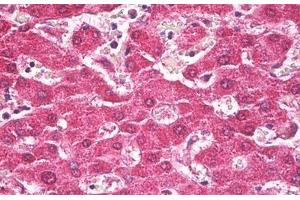 Anti-TROVE2 antibody IHC staining of human liver. (TROVE2 抗体)