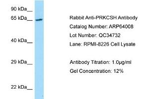 Western Blotting (WB) image for anti-Protein Kinase C Substrate 80K-H (PRKCSH) (N-Term) antibody (ABIN2789692) (PRKCSH 抗体  (N-Term))