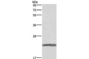 Western Blot analysis of Human placenta tissue using GH1 Polyclonal Antibody at dilution of 1:500 (Growth Hormone 1 抗体)