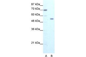 WB Suggested Anti-ZNF665 Antibody Titration:  1. (ZNF665 抗体  (N-Term))