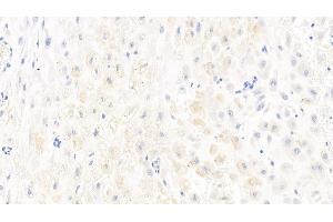 Detection of CASP1 in Human Placenta Tissue using Polyclonal Antibody to Caspase 1 (CASP1) (Caspase 1 抗体  (AA 120-297))