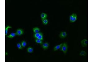 Immunofluorescence staining of HepG2 cells with ABIN7127519 at 1:30, counter-stained with DAPI. (Recombinant Glypican 3 抗体)