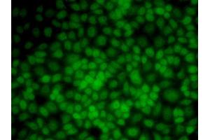 Immunofluorescence analysis of HeLa cells using UMPS antibody (ABIN5973202). (UMPS 抗体)