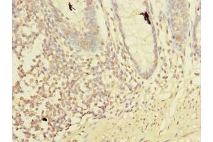 Immunohistochemistry of paraffin-embedded human colon tissue using ABIN7158359 at dilution of 1:100 (LMO3 抗体  (AA 1-145))