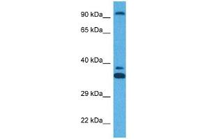 Host:  Rabbit  Target Name:  ZFX  Sample Tissue:  Human HT1080 Whole Cell  Antibody Dilution:  1ug/ml (ZFX 抗体  (N-Term))
