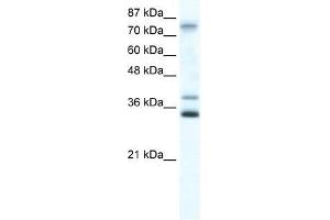ZNF570 antibody used at 0. (ZNF570 抗体  (N-Term))
