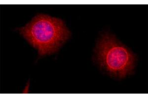 Indirect immunofluorescence on 3T3 cells (dilution 1 : 200; red).