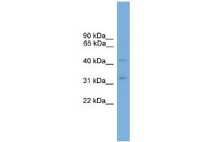 WB Suggested Anti-ALS2CR4 Antibody Titration:  0. (TMEM237 抗体  (Middle Region))