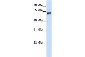 WB Suggested Anti-PHGDH Antibody Titration: 0. (PHGDH 抗体  (Middle Region))