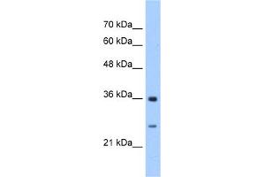 WB Suggested Anti-GSTZ1 Antibody Titration:  2. (GSTZ1 抗体  (N-Term))