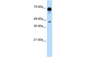 Western Blotting (WB) image for anti-Pseudouridylate Synthase 7 Homolog (PUS7) antibody (ABIN2462966) (PUS7 抗体)