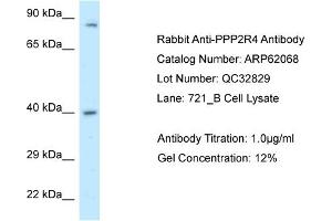 Western Blotting (WB) image for anti-Protein Phosphatase 2A Activator, Regulatory Subunit 4 (PPP2R4) (C-Term) antibody (ABIN2789006)