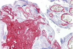 Immunohistochemistry with Placenta tissue at an antibody concentration of 5µg/ml using anti-FGG antibody (ARP44299_P050) (FGG 抗体  (Middle Region))