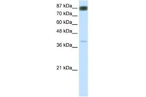 WB Suggested Anti-NFATC4 Antibody Titration:  0. (NFATC4 抗体  (N-Term))