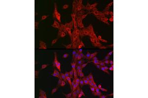 Immunofluorescence analysis of PC-12 cells using B Rabbit pAb (ABIN6129899, ABIN6136816, ABIN6136817 and ABIN6222589) at dilution of 1:100 (40x lens).