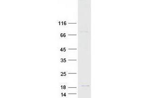 Western Blotting (WB) image for Angiogenin (ANG) (Transcript Variant 1) protein (Myc-DYKDDDDK Tag) (ABIN2714682)
