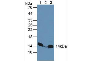 Western blot analysis of (1) Rat Heart Tissue, (2) Human Liver Tissue and (3) Mouse Liver Tissue. (MAPKSP1 抗体  (AA 1-124))