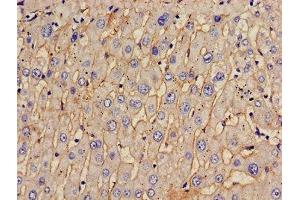 Immunohistochemistry of paraffin-embedded human liver tissue using ABIN7171513 at dilution of 1:100 (TOM1 抗体  (AA 306-487))