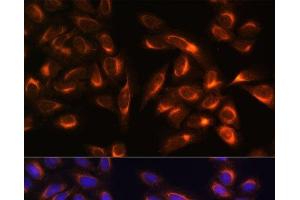 Immunofluorescence analysis of U-2 OS cells using PTCD1 Polyclonal Antibody at dilution of 1:100. (PTCD1 抗体)