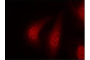 Image no. 1 for anti-Ribosomal Protein S6 Kinase, 90kDa, Polypeptide 1 (RPS6KA1) (pThr348) antibody (ABIN196796) (RPS6KA1 抗体  (pThr348))