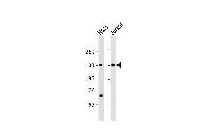 All lanes : Anti-MTUS1 Antibody (C-Term) at 1:2000 dilution Lane 1: Hela whole cell lysate Lane 2: Jurkat whole cell lysate Lysates/proteins at 20 μg per lane. (MTUS1 抗体  (AA 983-1017))